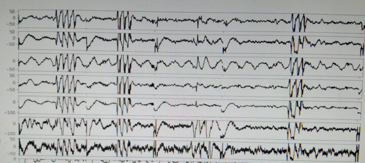 PiEEG captured data chewing blinking eyes