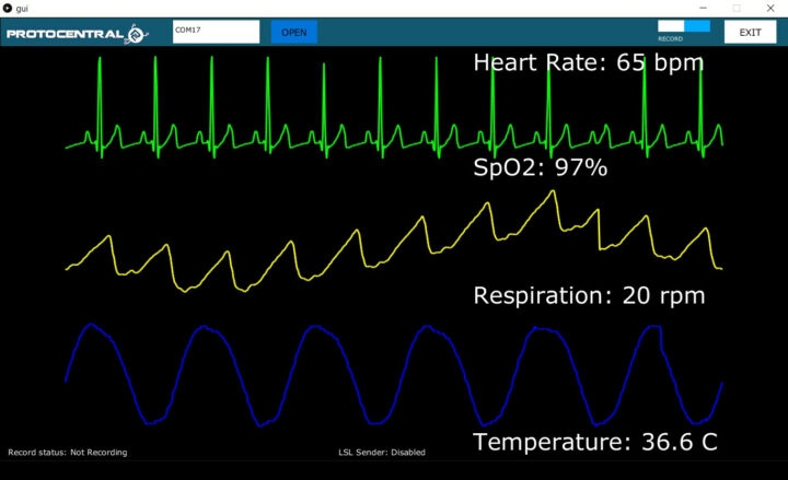 HealthyPi Desktop GUI