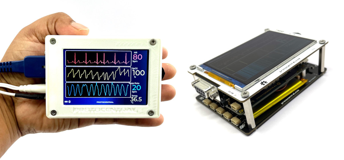 Standalone Vital Sign Monitor